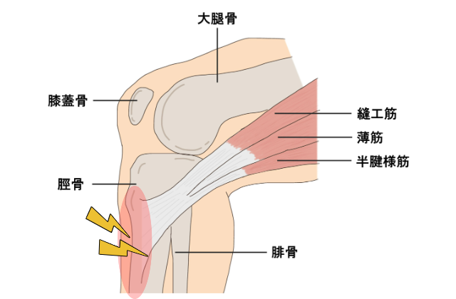 がそく炎図