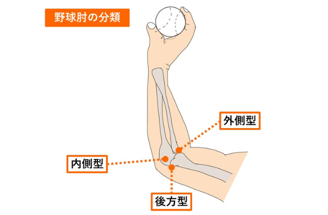 肘の解剖図