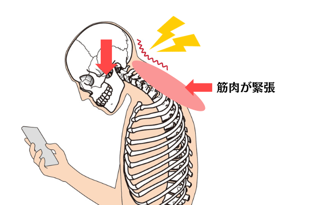 不良姿勢の図